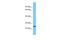 Transmembrane P24 Trafficking Protein 5 antibody, A12319, Boster Biological Technology, Western Blot image 