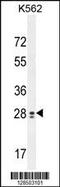 Testis Expressed 13B antibody, 55-494, ProSci, Western Blot image 