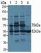 Proteasome 26S Subunit, ATPase 3 antibody, LS-C296085, Lifespan Biosciences, Western Blot image 