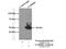 Gamma-Aminobutyric Acid Type A Receptor Beta1 Subunit antibody, 20183-1-AP, Proteintech Group, Immunoprecipitation image 