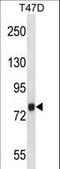 Zinc Finger CCCH-Type Containing 14 antibody, LS-C160735, Lifespan Biosciences, Western Blot image 