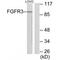 Fibroblast Growth Factor Receptor 3 antibody, A00200, Boster Biological Technology, Western Blot image 