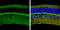 S100 Calcium Binding Protein B antibody, GTX129573, GeneTex, Immunohistochemistry frozen image 
