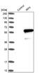 Interferon Regulatory Factor 4 antibody, NBP1-82813, Novus Biologicals, Western Blot image 