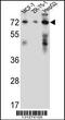 Hydroxysteroid 17-Beta Dehydrogenase 4 antibody, 56-474, ProSci, Western Blot image 