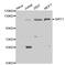 Sirtuin 1 antibody, MBS125996, MyBioSource, Western Blot image 