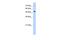 Sulfatase 2 antibody, PA5-43331, Invitrogen Antibodies, Western Blot image 