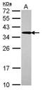 Ubiquitin Conjugating Enzyme E2 R2 antibody, GTX117722, GeneTex, Western Blot image 