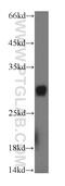 Proteasomal ATPase Associated Factor 1 antibody, 17650-1-AP, Proteintech Group, Western Blot image 