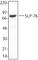 Lymphocyte Cytosolic Protein 2 antibody, 625002, BioLegend, Western Blot image 