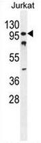 CWC22 Spliceosome Associated Protein Homolog antibody, AP51142PU-N, Origene, Western Blot image 