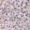 Inhibitor Of Nuclear Factor Kappa B Kinase Regulatory Subunit Gamma antibody, A0917, ABclonal Technology, Immunohistochemistry paraffin image 