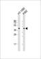 Phosphate Cytidylyltransferase 1, Choline, Alpha antibody, 56-255, ProSci, Western Blot image 