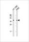 Choline-phosphate cytidylyltransferase A antibody, 56-255, ProSci, Western Blot image 