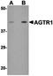 Angiotensin II type-1 receptor antibody, orb75272, Biorbyt, Western Blot image 