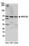 Spermatogenesis Associated Serine Rich 2 antibody, A304-971A, Bethyl Labs, Western Blot image 