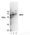 Mitogen-Activated Protein Kinase Kinase 5 antibody, A03980, Boster Biological Technology, Western Blot image 