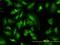 Serum/Glucocorticoid Regulated Kinase 1 antibody, H00006446-M01, Novus Biologicals, Immunofluorescence image 