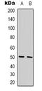 G Protein-Coupled Receptor 180 antibody, LS-C368969, Lifespan Biosciences, Western Blot image 