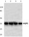 Aquaporin 5 antibody, A03085Y243, Boster Biological Technology, Western Blot image 