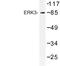 Mitogen-Activated Protein Kinase 6 antibody, LS-C177128, Lifespan Biosciences, Western Blot image 