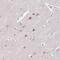 Actin Related Protein 3 antibody, PA5-61401, Invitrogen Antibodies, Immunohistochemistry paraffin image 