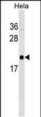 RWD Domain Containing 1 antibody, PA5-48881, Invitrogen Antibodies, Western Blot image 