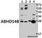 Abhydrolase Domain Containing 14B antibody, A13358, Boster Biological Technology, Western Blot image 