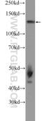 Nucleolar Protein 6 antibody, 15706-1-AP, Proteintech Group, Western Blot image 