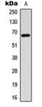 Estrogen Receptor 1 antibody, orb256526, Biorbyt, Western Blot image 