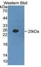 Interferon Alpha 2 antibody, MBS2026918, MyBioSource, Western Blot image 