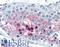Cathepsin V antibody, LS-B2775, Lifespan Biosciences, Immunohistochemistry paraffin image 