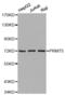 Protein Arginine Methyltransferase 5 antibody, STJ25148, St John