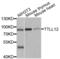 Tubulin Tyrosine Ligase Like 12 antibody, PA5-76352, Invitrogen Antibodies, Western Blot image 