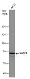 SHOC2 Leucine Rich Repeat Scaffold Protein antibody, GTX130206, GeneTex, Western Blot image 