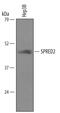 Sprouty Related EVH1 Domain Containing 2 antibody, AF4819, R&D Systems, Western Blot image 