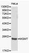 O-6-Methylguanine-DNA Methyltransferase antibody, abx000828, Abbexa, Western Blot image 