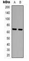 Eukaryotic Translation Initiation Factor 3 Subunit D antibody, LS-C368695, Lifespan Biosciences, Western Blot image 