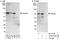 Sterile Alpha Motif Domain Containing 1 antibody, A303-578A, Bethyl Labs, Western Blot image 