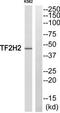 General Transcription Factor IIH Subunit 2 antibody, TA313984, Origene, Western Blot image 