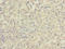 Complement C5 antibody, A58374-100, Epigentek, Immunohistochemistry paraffin image 