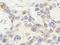 Zinc Finger Protein 592 antibody, NBP1-86647, Novus Biologicals, Immunocytochemistry image 