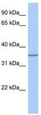 Glycosyltransferase 6 Domain Containing 1 antibody, TA331015, Origene, Western Blot image 