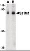 Stromal Interaction Molecule 1 antibody, orb87362, Biorbyt, Western Blot image 