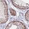 TRNA Methyltransferase 6 antibody, PA5-61409, Invitrogen Antibodies, Immunohistochemistry frozen image 