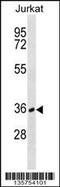 CD226 Molecule antibody, 58-455, ProSci, Western Blot image 