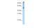 Eukaryotic Translation Initiation Factor 2A antibody, A02418, Boster Biological Technology, Western Blot image 