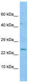 Bone Morphogenetic Protein 8a antibody, TA337727, Origene, Western Blot image 