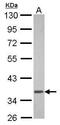 G Protein Subunit Alpha Transducin 1 antibody, PA5-28336, Invitrogen Antibodies, Western Blot image 