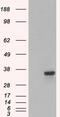 Proteasome Inhibitor Subunit 1 antibody, GTX89875, GeneTex, Western Blot image 